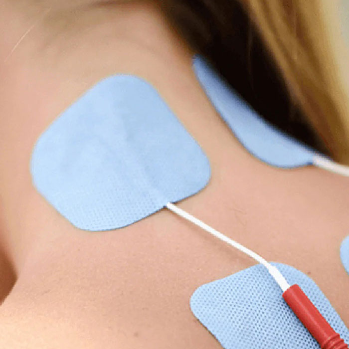 Electroestimulación